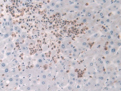 巨噬细胞炎性蛋白3α(MIP3a)单克隆抗体