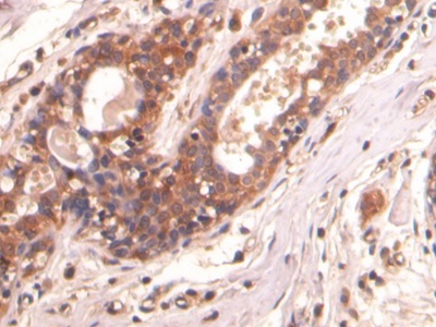 连环蛋白β1(β-catenin)单克隆抗体