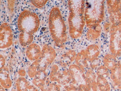 连环蛋白β1(β-catenin)单克隆抗体