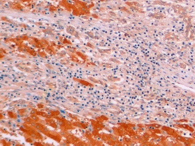 连环蛋白β1(β-catenin)单克隆抗体