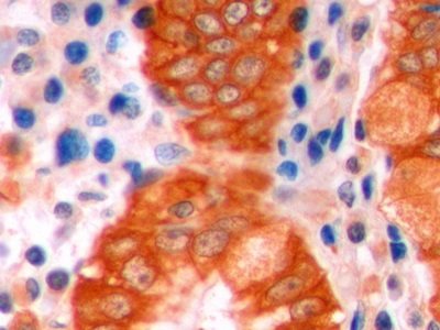 连环蛋白β1(β-catenin)单克隆抗体