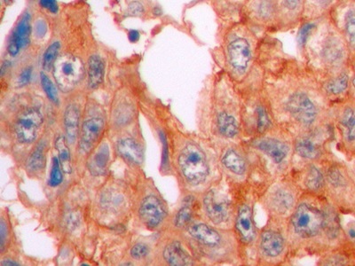 连环蛋白β1(β-catenin)单克隆抗体
