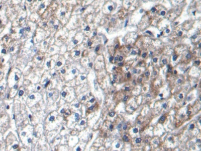 連環(huán)蛋白β1(β-catenin)單克隆抗體