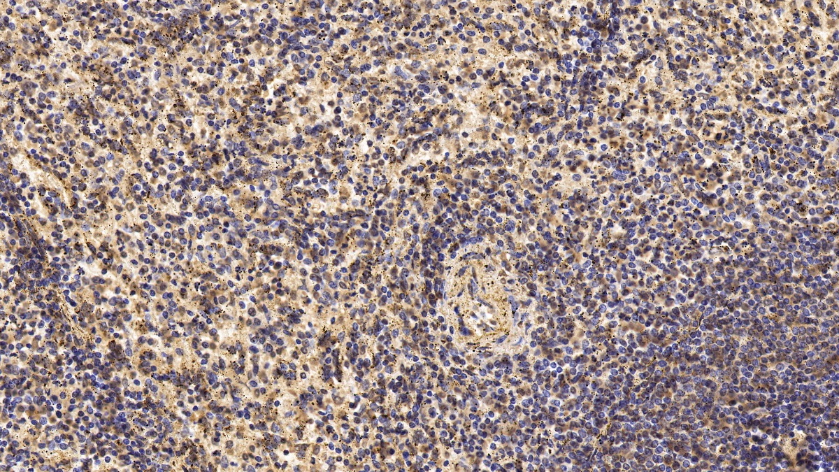 T-细胞表面糖蛋白CD3ε(CD3e)单克隆抗体