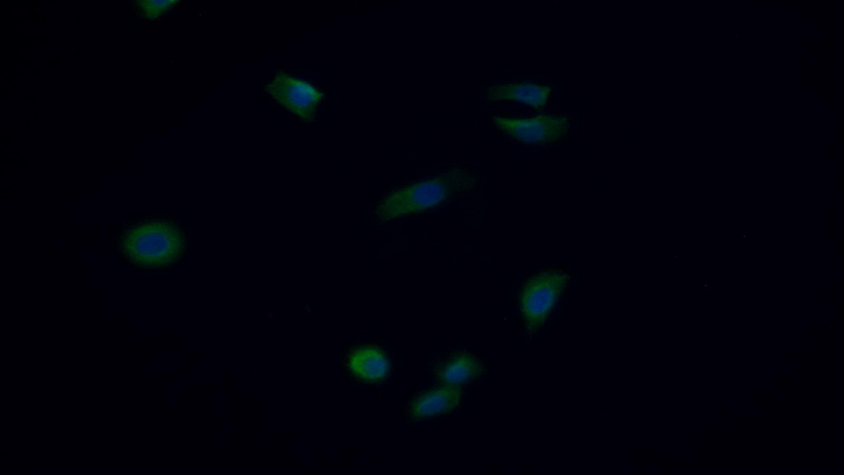 死骨片1(SQSTM1)单克隆抗体