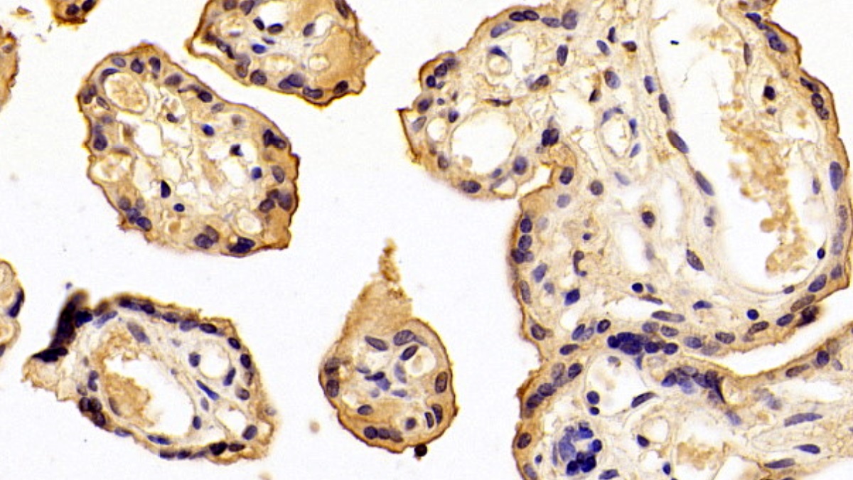 膜聯(lián)蛋白A4(ANXA4)單克隆抗體