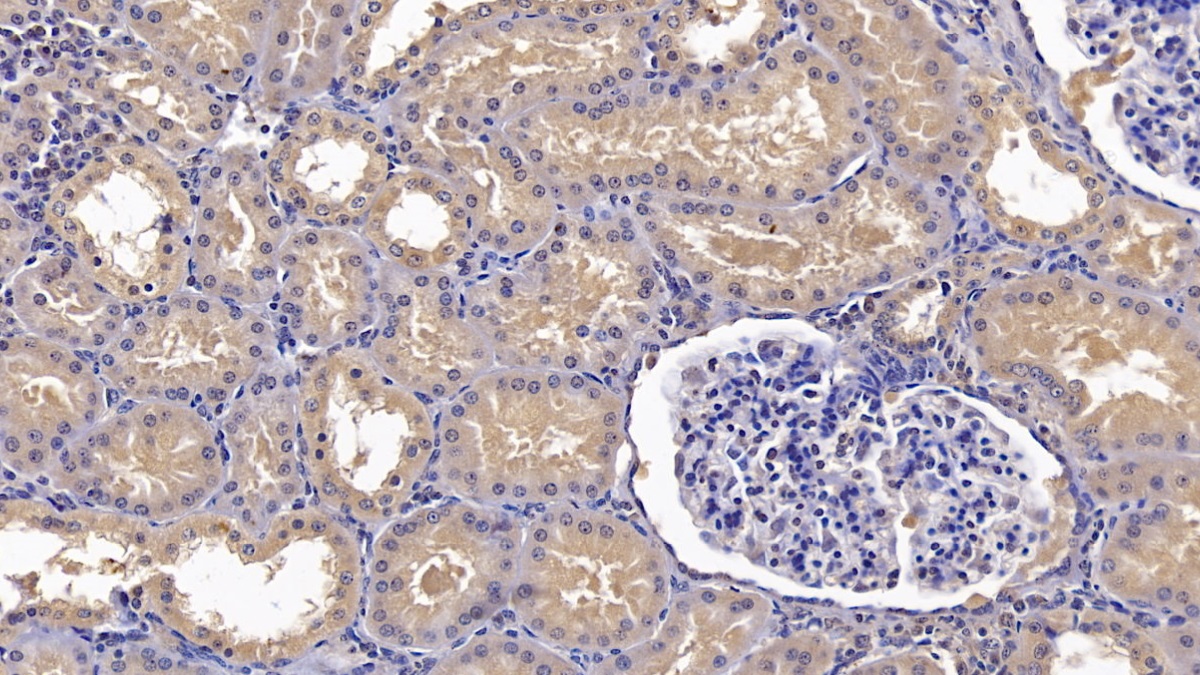 膜聯(lián)蛋白A3(ANXA3)單克隆抗體