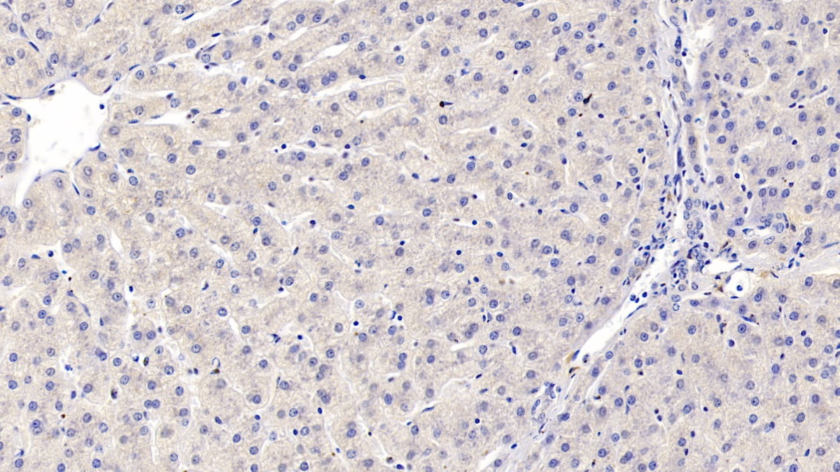 膜聯(lián)蛋白A3(ANXA3)單克隆抗體