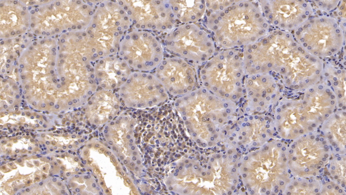 膜聯(lián)蛋白A3(ANXA3)單克隆抗體