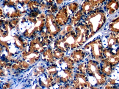 膜聯(lián)蛋白A1(ANXA1)單克隆抗體