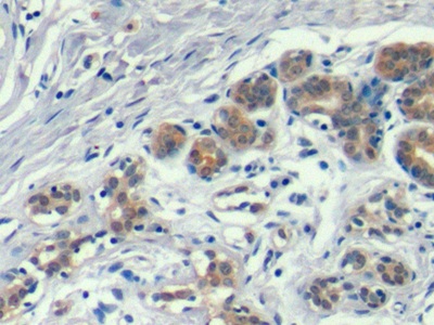 膜聯(lián)蛋白A1(ANXA1)單克隆抗體