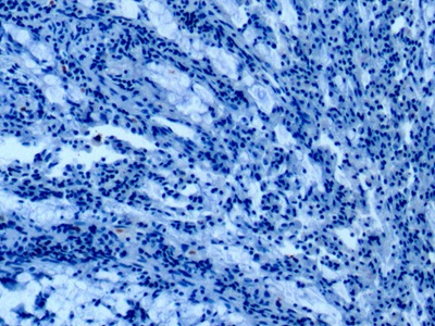 膜聯(lián)蛋白A1(ANXA1)單克隆抗體