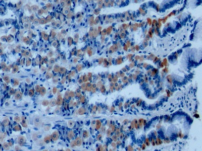 膜聯(lián)蛋白A1(ANXA1)單克隆抗體