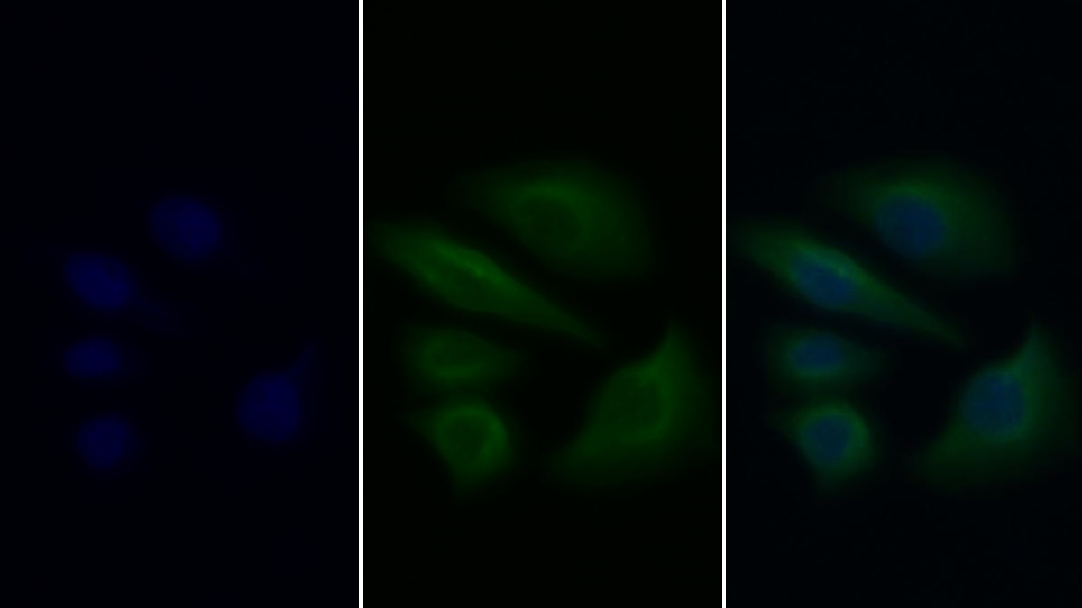 膜聯(lián)蛋白A1(ANXA1)單克隆抗體