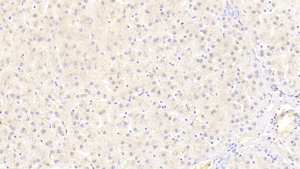 苄氯素1(BECN1)单克隆抗体