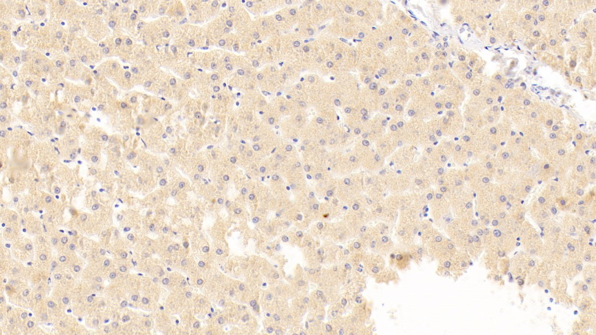 巨噬细胞炎性蛋白1β(MIP1b)多克隆抗体
