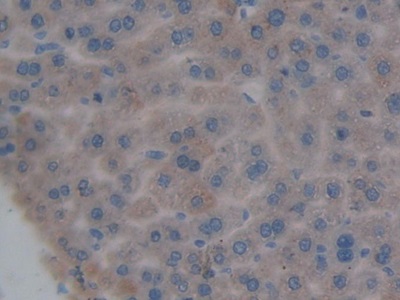 脱氧核糖核酸酶Ⅰ样2(DNASE1L2)多克隆抗体