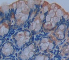 连环蛋白β1(β-catenin)多克隆抗体
