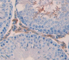 連環(huán)蛋白β1(β-catenin)多克隆抗體