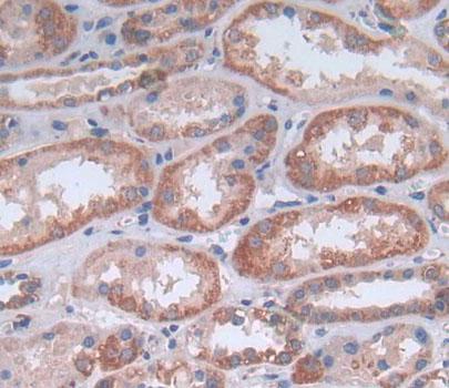 硫酸軟骨素蛋白聚糖4(CSPG4)多克隆抗體