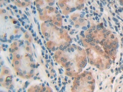 硫酸軟骨素蛋白聚糖4(CSPG4)多克隆抗體