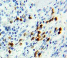 視網(wǎng)膜母細(xì)胞瘤蛋白1(RB1)多克隆抗體