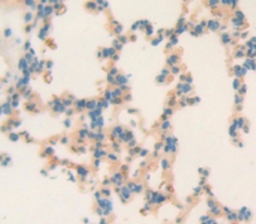 孕酮受體(PGR)多克隆抗體