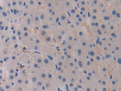 乳腺癌易感蛋白1(BRCA1)多克隆抗体
