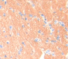 乳腺癌易感蛋白1(BRCA1)多克隆抗体