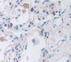 整合素β2(CD18)多克隆抗体