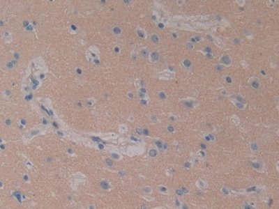 信号转导衔接分子1(STAM1)多克隆抗体