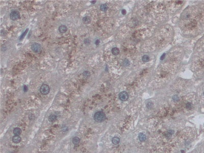 CD209分子(CD209)多克隆抗体