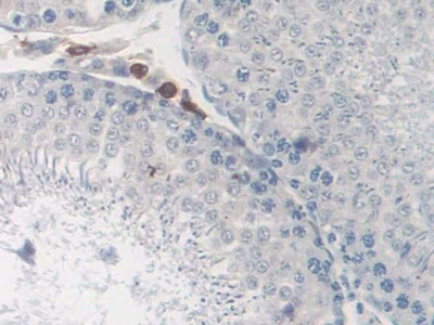 CD163分子(CD163)多克隆抗体