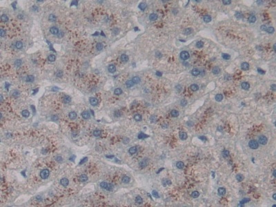 CD301分子(CD301)多克隆抗体