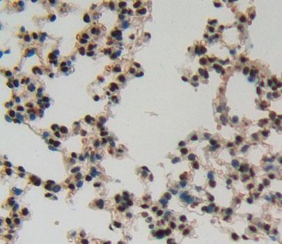 干扰素调节因子8(IRF8)多克隆抗体