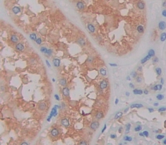 硒蛋白P1(SEPP1)多克隆抗体