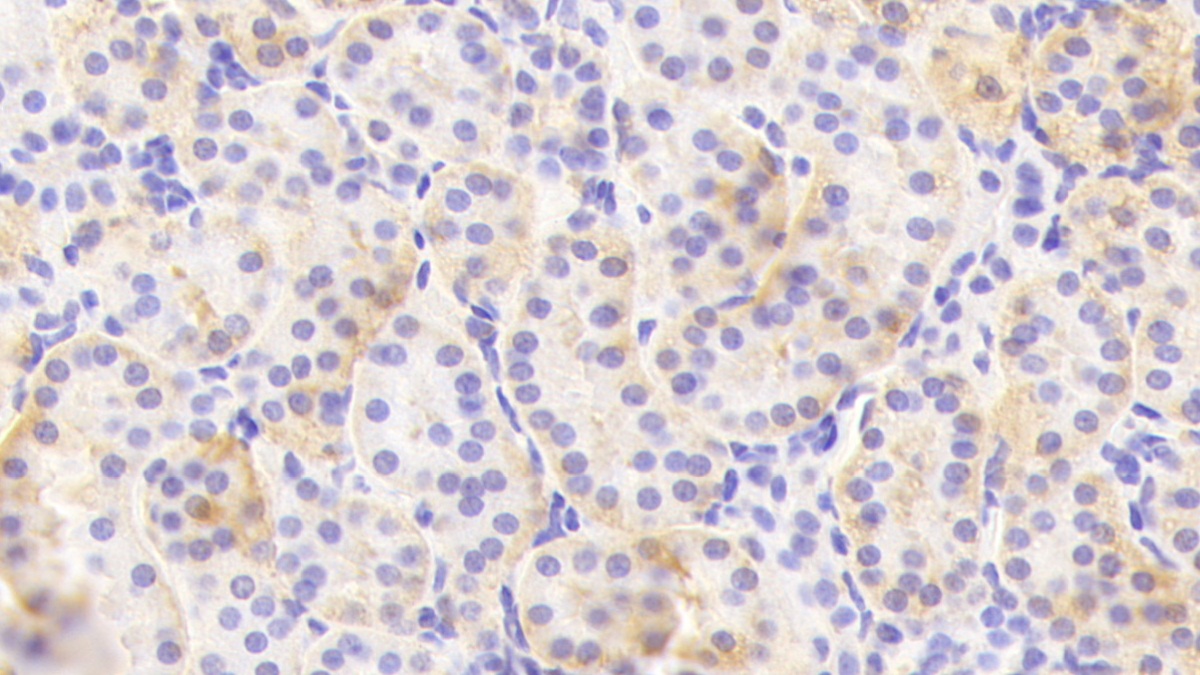 烟碱型胆碱受体α4(CHRNa4)多克隆抗体