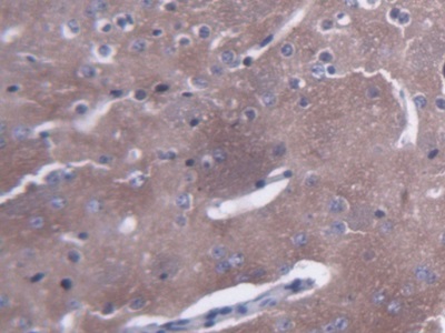 两性蛋白(AMPH)多克隆抗体