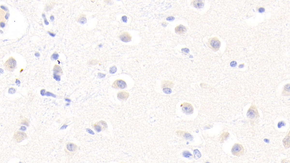 α白蛋白(AFM)多克隆抗体