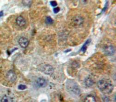 α白蛋白(AFM)多克隆抗体