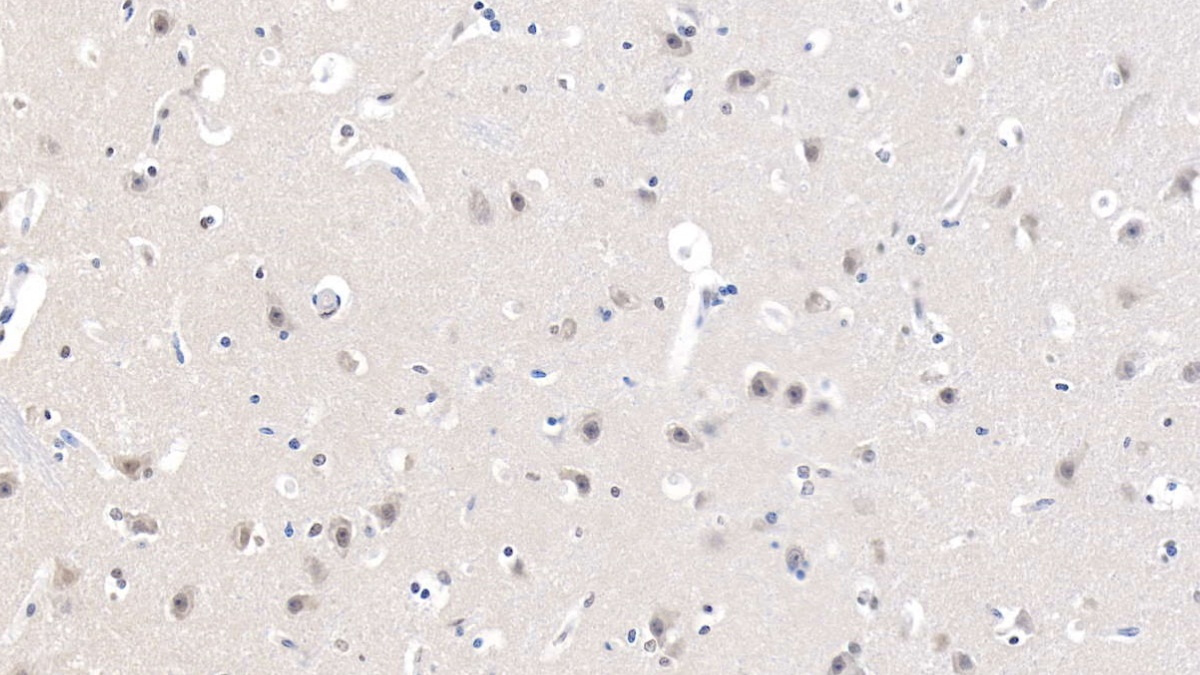 烟碱型胆碱受体α7(CHRNa7)多克隆抗体