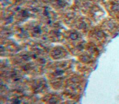 白细胞衍生趋化因子1(LECT1)多克隆抗体