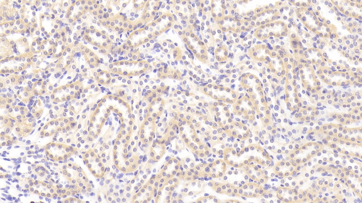 肿瘤坏死因子相关配体分子1A(TL1A)多克隆抗体