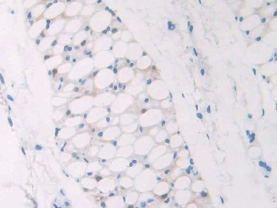 核仁磷酸蛋白(NPM1)多克隆抗体