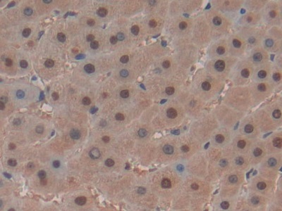 胰腺特异转录因子1α(PTF1a)多克隆抗体