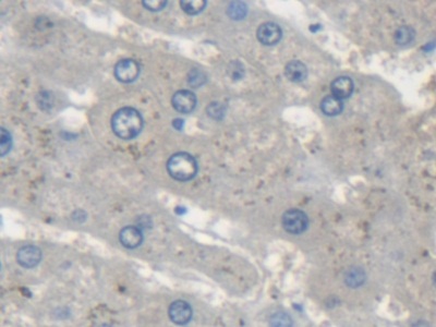 信号转导衔接分子2(STAM2)多克隆抗体
