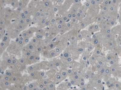 基質(zhì)相互作用分子1(STIM1)多克隆抗體