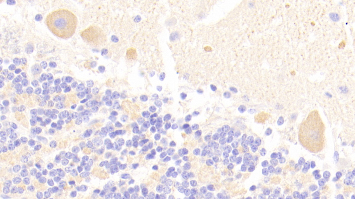 烟碱型胆碱受体α3(CHRNa3)多克隆抗体