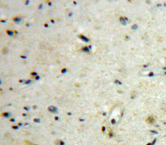 绒毛膜促性腺激素β肽(CGb)多克隆抗体