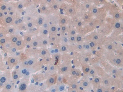 线粒体铁蛋白(FTMT)多克隆抗体